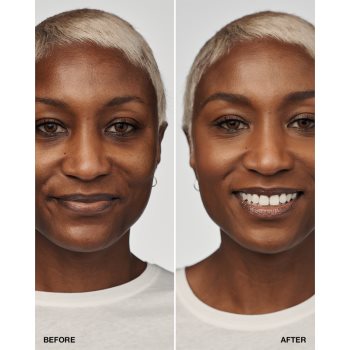 Clinique Even Better Clinical Serum Foundation SPF 20 machiaj de îngrijire SPF 20 - 1 | YEO