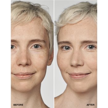 Clinique Even Better Clinical Serum Foundation SPF 20 machiaj de îngrijire SPF 20 - 1 | YEO