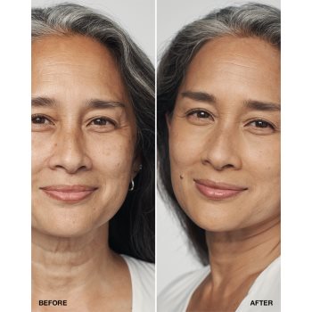 Clinique Even Better Clinical Serum Foundation SPF 20 machiaj de îngrijire SPF 20 - 1 | YEO
