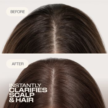 Cosmetice și accesorii, Goldwell Dualsenses Scalp Specialist Clarifying Shampoo curatarea profunda a scalpului - Sellmag.ro