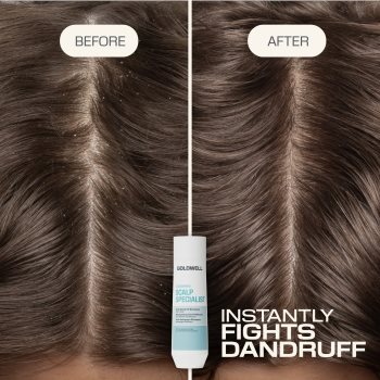 Goldwell Dualsenses Scalp Specialist Anti-Dandruff Shampoo sampon anti-matreata Goldwell Dualsenses Scalp Specialist Anti-Dandruff Shampoo sampon anti-matreata - Sellmag.ro
