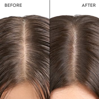 KERASILK Specialists Exfoliating Scalp & Hair Treatment tratament pre-sampon cu efect de exfoliere KERASILK Specialists Exfoliating Scalp & Hair Treatment tratament pre-sampon cu efect de exfoliere 2 - Sellmag.ro