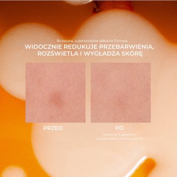 Lumene Nordic-C [VALO] Dark Spot Serum ser stralucire cu vitamina C impotriva petelor - imagine 2