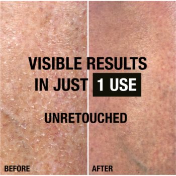 Neutrogena Norwegian Formula® Intense Repair set cadou pentru recuperare rapida - 1 | YEO